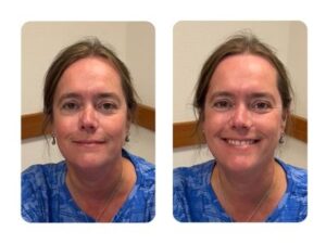 Stoelmassage voor en na 1